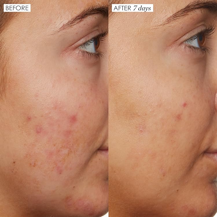Sunday Riley | Green Technology Formulations – Potent Actives That Respect Your Skin Barrier
