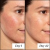 image:imageSunday Riley A HighDose Anti Aging Retinol Serum05 Ounce Pack of 1