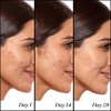 image:imageSunday Riley A HighDose Anti Aging Retinol Serum17 Fl Oz Pack of 1