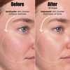 image:imageSunday Riley AI Adaptive Retinoid Serum For Blemish Prone SkinOff White