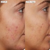 image:imageSunday Riley B3 Nice 10 Niacinamide Serum 10ozNo Color