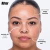 image:imageSunday Riley Breakout Breakup Salicylic Acid Cleanser for BlemishProne SkinPurple