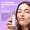 image:imageSunday Riley Detox Darling Balancing Essence Mist for Oily and BlemishProne SkinPurple