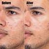 image:imageSunday Riley Peacekeeper Azaleic and Salicylic Acid Acne Treatment SerumOff White