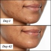 image:imageSunday Riley UFO UltraClarifying Salicylic Acid and Tea Tree Acne Treatment Face Oil05 Fl Oz Pack of 1